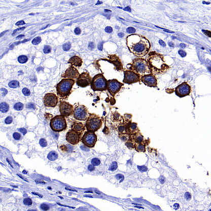 GLUT3 + GLUT14 Recombinant Rabbit mAb (S-5945)