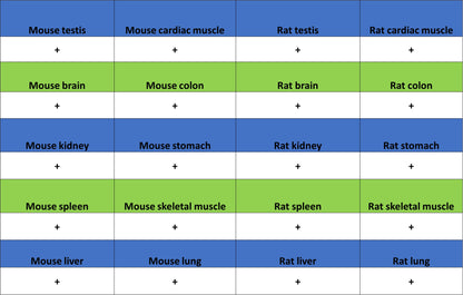 ATP Citrate Lyase Recombinant Rabbit mAb (S-5036)