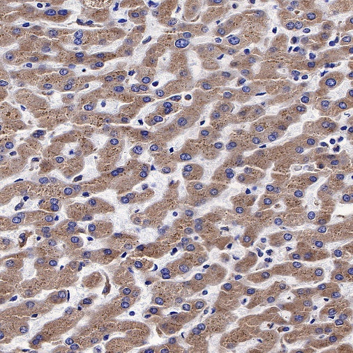 Calreticulin Recombinant Rabbit mAb (S-R353)