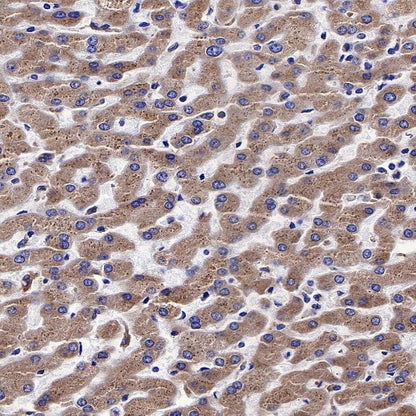 Calreticulin Recombinant Rabbit mAb (S-R353)