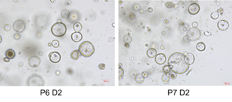 Colon organoid Cytokine Set, Mouse/小鼠结肠类器官细胞因子套装