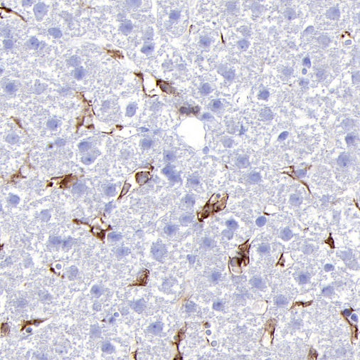 CSF-1R Recombinant Rabbit mAb (S-467-26)