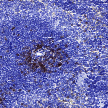 CD3 epsilon Recombinant Rabbit mAb (SDT-241-49)