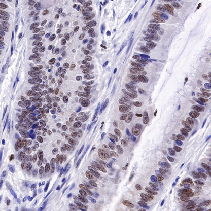 PMS2 Recombinant Rabbit mAb (SDT-111-307)