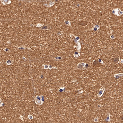 p38 MAPK Recombinant Rabbit mAb (S-508-19)