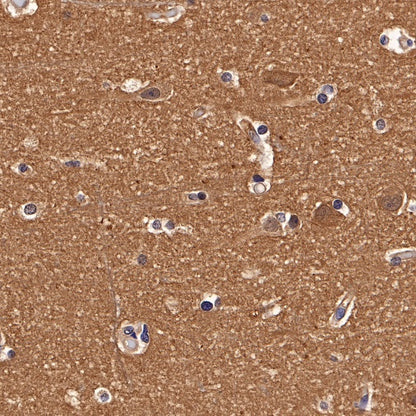 p38 MAPK Recombinant Rabbit mAb (S-508-19)