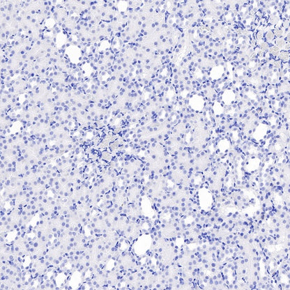 Neurofilament L Recombinant Rabbit mAb (S-635-214)