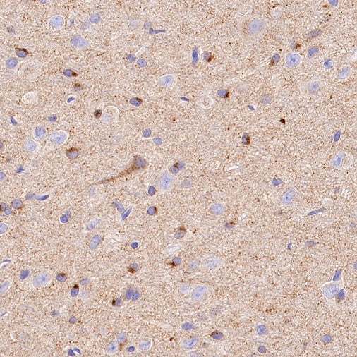 ATG9A Recombinant Rabbit mAb (S-1418-5)