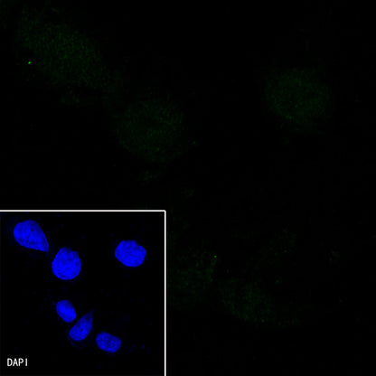 PEG10 Recombinant Rabbit mAb (SDT-442-60)