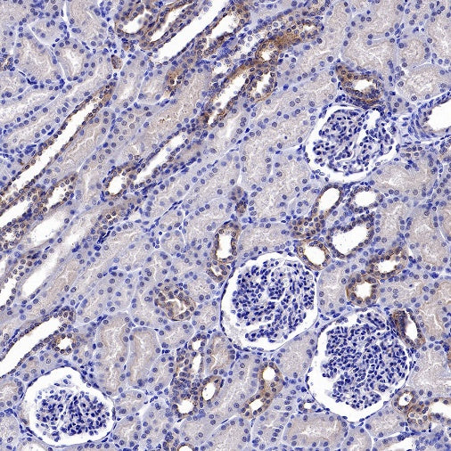 Cortactin Recombinant Rabbit mAb (S-1303-10)