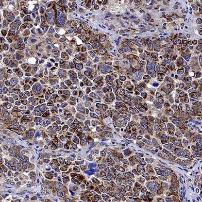 PYCR1 Rabbit Polyclonal Antibody