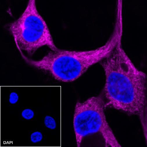 β-tubulin Recombinant Rabbit mAb (Cy5 Conjugate) (S-312-113)