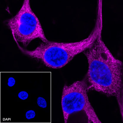 β-tubulin Recombinant Rabbit mAb (Cy5 Conjugate) (S-312-113)