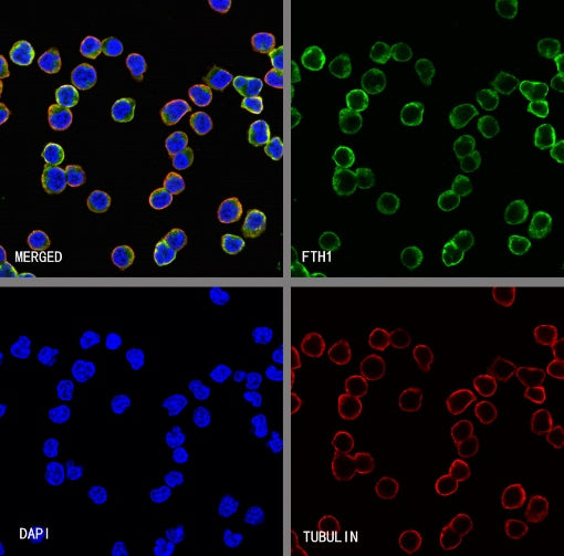 FTH1 Recombinant Rabbit mAb (S-1372-136)
