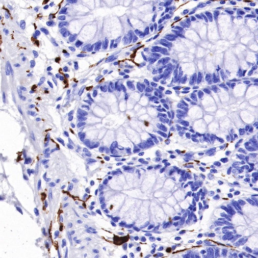 S-RMab® S100B Recombinant Rabbit mAb (SDT-518-45)