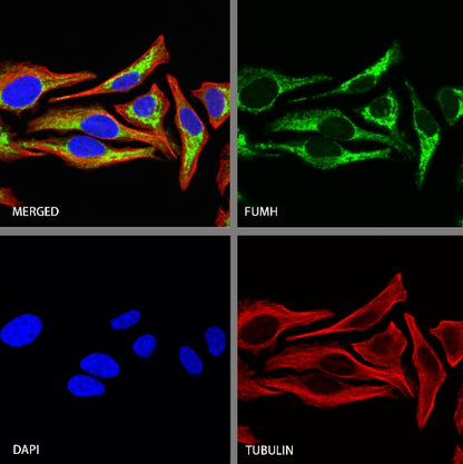 Fumarate hydratase Recombinant Rabbit mAb (SDT-2394-36)
