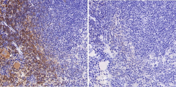 Phospho- Zap-70 (Tyr319)/Syk (Tyr352) Recombinant Rabbit mAb (S-1252-12)