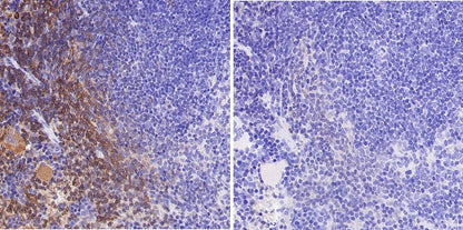 Phospho- Zap-70 (Tyr319)/Syk (Tyr352) Recombinant Rabbit mAb (S-1252-12)