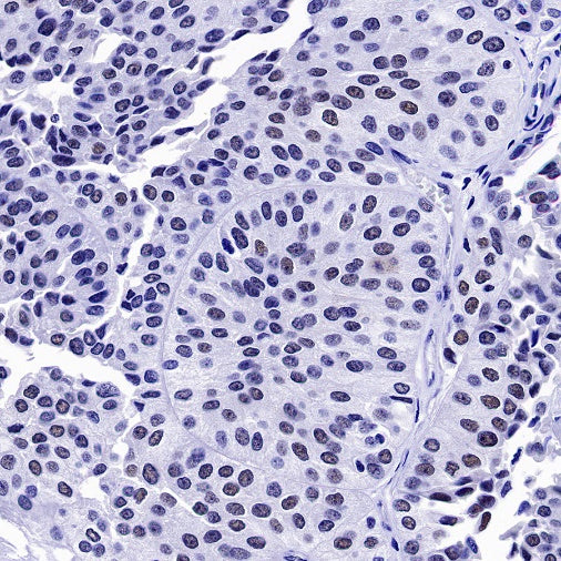 S-RMab® PMS2 Recombinant Rabbit mAb (SDT-R460)