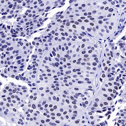 S-RMab® PMS2 Recombinant Rabbit mAb (SDT-R460)