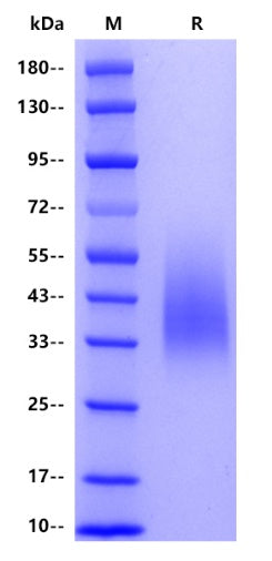 CD86 His Tag Protein, Mouse
