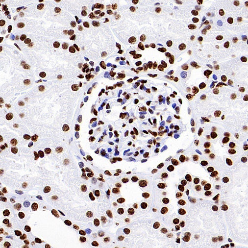 Histone H3 (acetyl K9) Recombinant Rabbit mAb (S-1704-76)