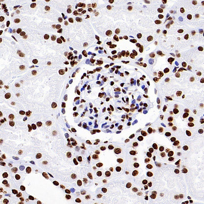 Histone H3 (acetyl K9) Recombinant Rabbit mAb (S-1704-76)