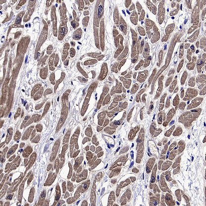 MYBPC3 Recombinant Rabbit mAb (S-5476)