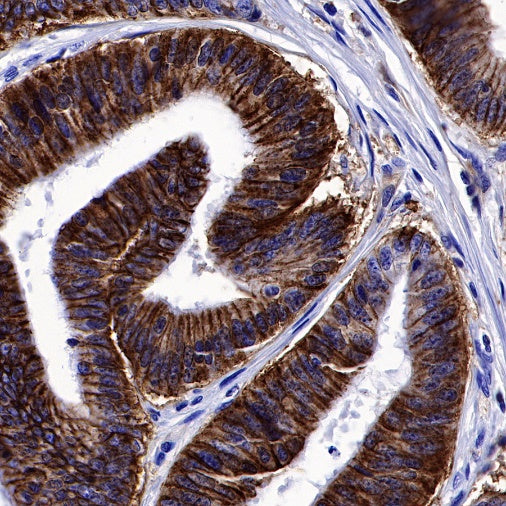 NDRG1 Recombinant Rabbit mAb (S-623-82)
