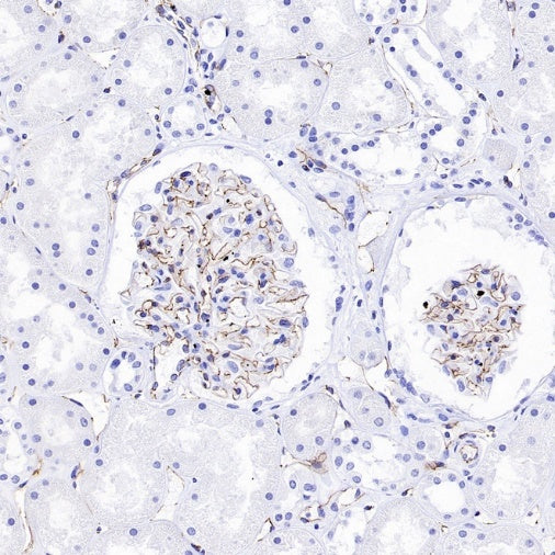 VE Cadherin Recombinant Rabbit mAb (S-3312-118)