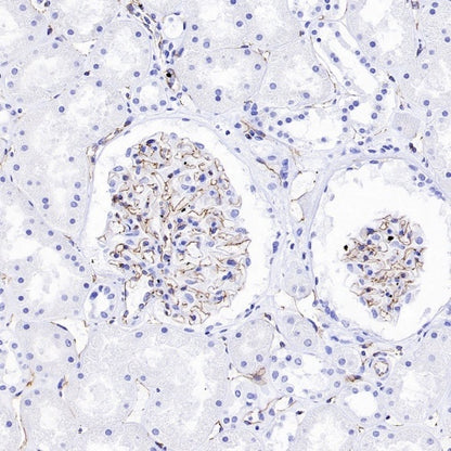 VE Cadherin Recombinant Rabbit mAb (S-3312-118)