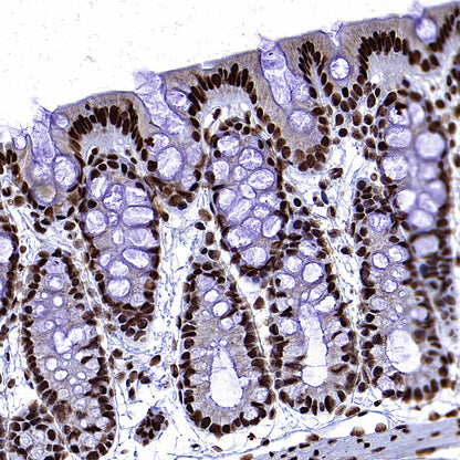 EIF4A3 Mouse mAb