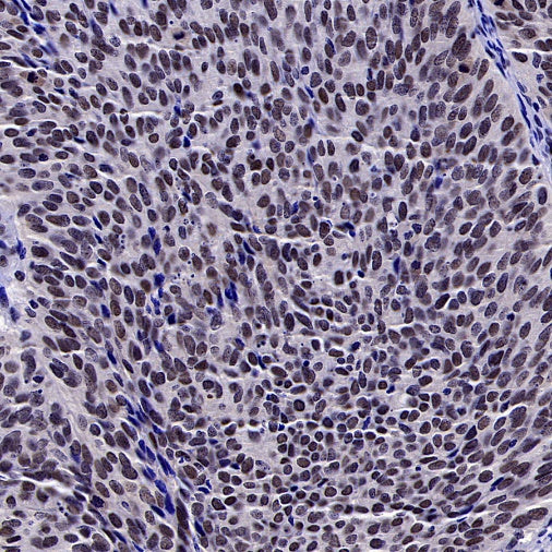 SREBP2 Recombinant Rabbit mAb (S-2701-1)