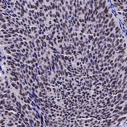 SREBP2 Recombinant Rabbit mAb (S-2701-1)