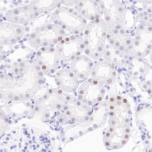 Histone H3 (tri methyl K27) Recombinant Rabbit mAb (S-4098)
