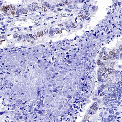 ATF3 Recombinant Rabbit mAb (S-3904)