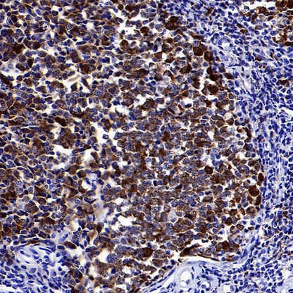 PRDM1/Blimp1 Recombinant Rabbit mAb (S-1972-3)