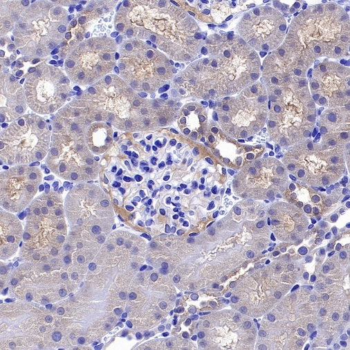DLAT Rabbit Polyclonal Antibody