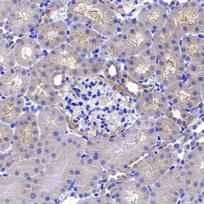 DLAT Rabbit Polyclonal Antibody