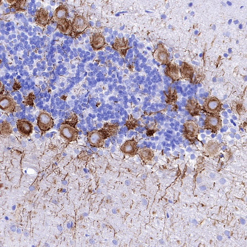 Neurofilament H Recombinant Rabbit mAb (S-532-103)