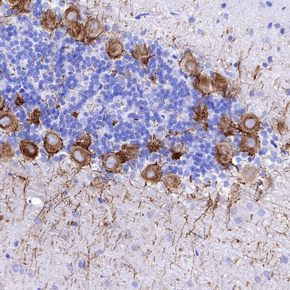 Neurofilament H Recombinant Rabbit mAb (S-532-103)