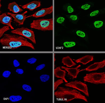 U2AF2 Recombinant Rabbit mAb (S-1324-1)