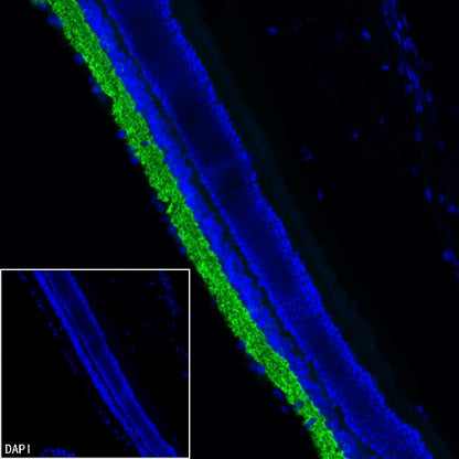 SLC6A1 Recombinant Rabbit mAb (SDT-2424-278)