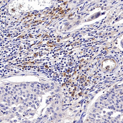 PLCγ2 Recombinant Rabbit mAb (S-2749-14)
