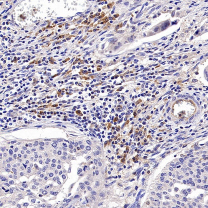 PLCγ2 Recombinant Rabbit mAb (S-2749-14)