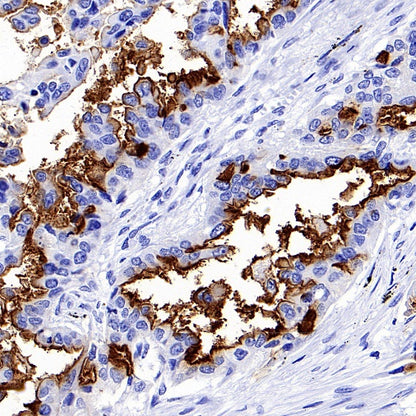 NaPi2b/SLC34A2 Recombinant Rabbit mAb (SDT-R229)