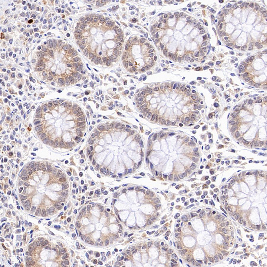 PDIA3 Rabbit Polyclonal Antibody