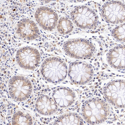 PDIA3 Rabbit Polyclonal Antibody