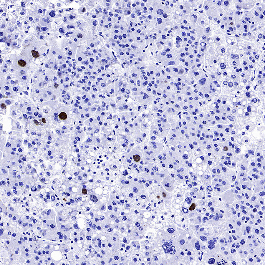 Phospho-DNA-PKcs (Ser2056) Recombinant Rabbit mAb (S-3813)