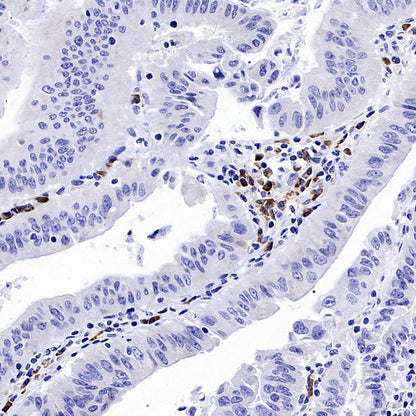 MACIR Rabbit Polyclonal Antibody
